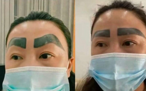 แทบร้องไห้! หญิงจีนสักคิ้ว ได้คิ้วหนาเหมือนปลิง แถมร้านชดเชยแค่ 1,000 บาท