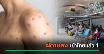 ไทม์ไลน์ผู้ป่วยฝีดาษลิงเข้าไทย 1 ราย เสี่ยงสูง 12 คน - อีกเคสโรคเริม ป่วย 5